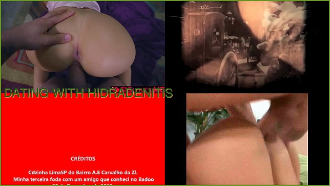 Dating With Hidradenitis Suppurativa Tips For Communication Porn Yuan Dated